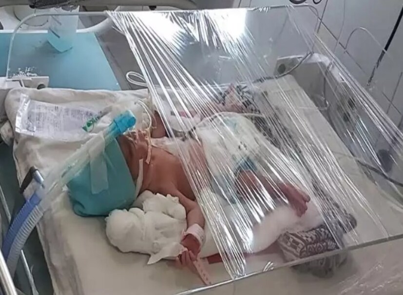 • হাসপাতালের তরফে জানানো হয়েছে, অন্তত ৪-৬ সপ্তাহ মা ও শিশুদের হাসপাতালে থাকতে হবে ৷ 