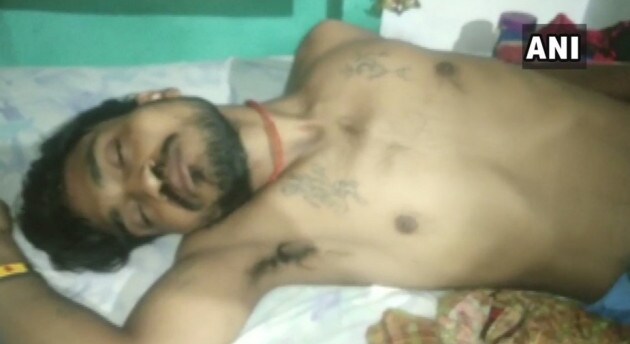 নেশায় মধ্যে সাপকে দাঁত দিতে কেটে টুকরো টুকরো কেটে ফেললেন যুবক ৷ শুধু দাঁত দিয়ে কামড়ে ছেড়ে দেয়নি যুবক ৷ বরং দাঁত দিতে তাকে টুকরো টুকরো করে কেটে ফেলে যুবক ৷ এপর অবস্থা আশঙ্কাজনক হয়ও পড়ায় পরিবারের সদস্যরা তাকে হাসপাতালে ভর্তি করে ৷ নেশায় মধ্যে সাপকে দাঁত দিতে কেটে টুকরো টুকরো কেটে ফেললেন যুবক ৷ শুধু দাঁত দিয়ে কামড়ে ছেড়ে দেয়নি যুবক ৷ বরং দাঁত দিতে তাকে টুকরো টুকরো করে কেটে ফেলে যুবক ৷ এপর অবস্থা আশঙ্কাজনক হয়ও পড়ায় পরিবারের সদস্যরা তাকে হাসপাতালে ভর্তি করে ৷