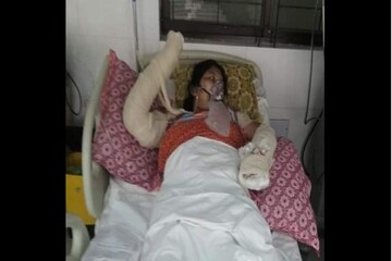 ভোররাতে এসি থেকে আগুন লেগে গুরুতর আহত ৯ মাসের শিশুসহ পুরো পরিবার ! দেখুন ছবি ভোররাতে এসি থেকে আগুন লেগে গুরুতর আহত ৯ মাসের শিশুসহ পুরো পরিবার ! দেখুন ছবি