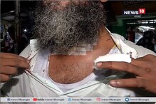 ঘুড়ির সুতোয় গলা কাটল বাইক চালকের ! কোনও রকমে প্রাণে বাঁচলেন ! দেখুন ভিডিও ঘুড়ির সুতোয় গলা কাটল বাইক চালকের ! কোনও রকমে প্রাণে বাঁচলেন ! দেখুন ভিডিও