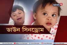 ডাউন সিনড্রোম মোকাবিলায় গবেষণা, পথ দেখাল কলকাতা বিশ্ববিদ্যালয় ডাউন সিনড্রোম মোকাবিলায় গবেষণা, পথ দেখাল কলকাতা বিশ্ববিদ্যালয়