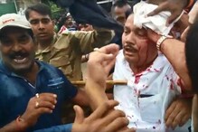 ফের রণক্ষেত্র কাঁকিনাড়া, মাথা ফাটল বিজেপি সাংসদ অর্জুন সিংয়ের , চলল গুলিও ফের রণক্ষেত্র কাঁকিনাড়া, মাথা ফাটল বিজেপি সাংসদ অর্জুন সিংয়ের , চলল গুলিও