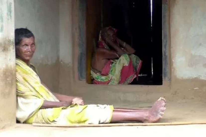 একদিকে প্রতিবেশীরা তাঁকে একঘরে করে রেখে দিয়েছেন অন্যদিকে তাঁর অসুবিধা আরও বাড়িয়ে দেয় তাঁকে যখন দূর দূর থেকে লোক দেখতে আসে তাঁর শারীরিক বৈশিষ্ট্যের জন্য ৷ নিজকে ঘরে বন্দি করে রাখেন মহিলা ৷ Photo- Picture: SWNS