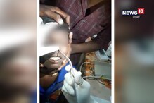 পুকুরে স্নান করতে নেমে কিশোরের নাকে ঢুকে গেল মাছ ! তারপর ? পুকুরে স্নান করতে নেমে কিশোরের নাকে ঢুকে গেল মাছ ! তারপর ?