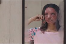 Chhapaak Trailer: অ্যাসিডে আক্রান্ত দীপিকা, ট্রেলারেই বাজিমাত ! Chhapaak Trailer: অ্যাসিডে আক্রান্ত দীপিকা, ট্রেলারেই বাজিমাত !