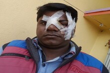চিনা মাঞ্জা সুতোয় গুরুতর আহত যুবক, চোখ নষ্টের আশঙ্কা !