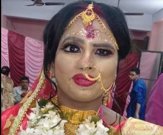২০১৪ সালে সঞ্চয়িতার প্রেমিক, প্রেমে ব্যর্থ হওয়ার পর অ্যাসিড ছুঁড়ে মেরেছিল তাঁর মুখে ৷ তাঁর মুখশ্রীকে ‘বিশ্রী’ বানিয়ে প্রেমিক ভেবেছিল জীবনটা নষ্ট করবে সঞ্চয়িতা ৷ Photo: Facebook ২০১৪ সালে সঞ্চয়িতার প্রেমিক, প্রেমে ব্যর্থ হওয়ার পর অ্যাসিড ছুঁড়ে মেরেছিল তাঁর মুখে ৷ তাঁর মুখশ্রীকে ‘বিশ্রী’ বানিয়ে প্রেমিক ভেবেছিল জীবনটা নষ্ট করবে সঞ্চয়িতা ৷ Photo: Facebook