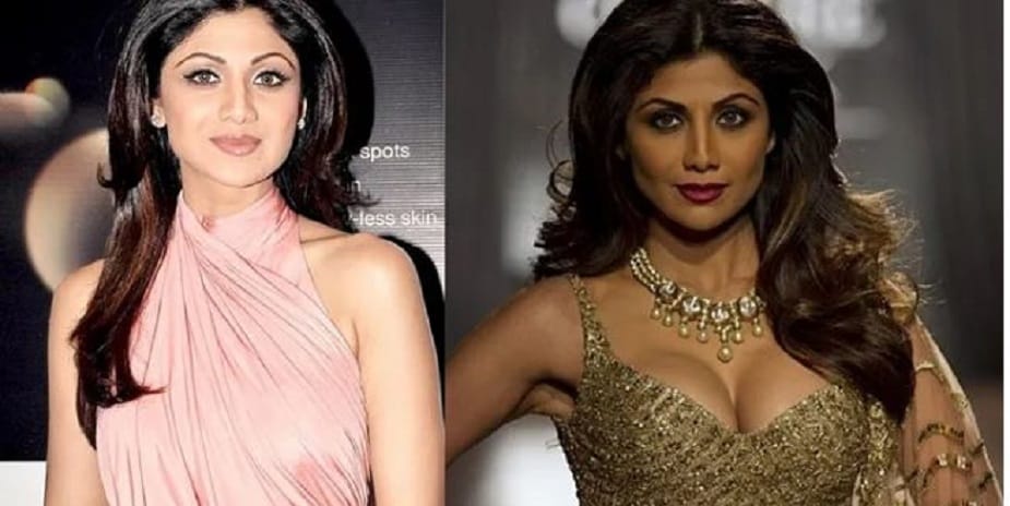 শিল্পা শেট্টি- 'বাজিগর'-এ শিল্পা আর এখনকার শিল্পা... স্পষ্ট কসমেটিক সার্জারি করে নাক টিকালো করার পাশাপাশি তিনি অপারেশন করে স্তনের আকারও বাড়িয়েছেন। শিল্পা শেট্টি- 'বাজিগর'-এ শিল্পা আর এখনকার শিল্পা... স্পষ্ট কসমেটিক সার্জারি করে নাক টিকালো করার পাশাপাশি তিনি অপারেশন করে স্তনের আকারও বাড়িয়েছেন।