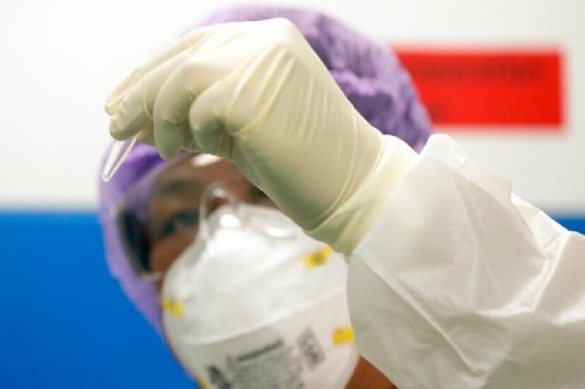 বদলাচ্ছে করোনাভাইরাসের চরিত্র। বিশেষজ্ঞরা মনে করছেন, গুজরাটে সক্রিয় এল-টাইপ ভাইরাস যা দেখা গিয়েছে চিনের উহানে।