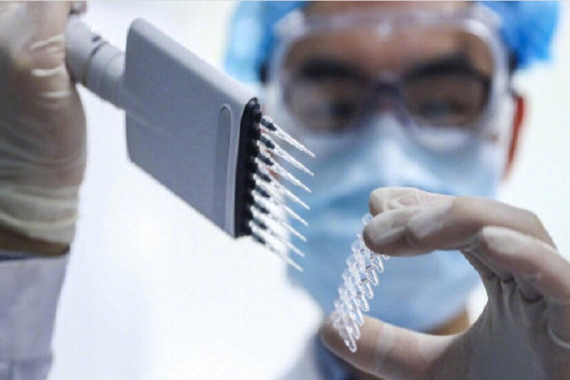 এর পাশাপাশি ফরাঁসি ওষুধ সংস্থা Sanofi-র তৈরি ভ্যাকসিনের কাজও অনেক দূর এগিয়ে গিয়েছে৷ GSK-এর সঙ্গে এই প্রতিষেধক তৈরি করছে Sanofi৷ সেপ্টেম্বর থেকে ডিসেম্বরের মধ্যে এই প্রতিষেধকের প্রথম এবং দ্বিতীয় পর্যায়ের ক্লিনিক্যাল ট্রায়াল শুরু করতে জোর গতিতে কাজ চলছে৷ PHOTO- FILE