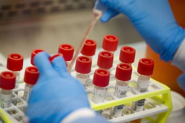 মেরিল্যান্ডের National Biodefense Analysis and Countermeasures Center-র রিসার্চের স্লাইড দেখিয়ে উইলিয়াম ব্রায়ান জানিয়েছেন, ৭০ থেকে ৭৫ ডিগ্রি ফারেনহাইট বা ২১ থেক ২৪ ডিগ্রি সেলসিয়াস তাপমাত্র তার সঙ্গে ২০ শতাংশ আর্দ্রতার যোগ হলে ১৮ ঘন্টায় নন পোরাস সারফেসে জীবাণুর জীবন অর্ধেক হয়ে যায় ৷ Photo- Representive মেরিল্যান্ডের National Biodefense Analysis and Countermeasures Center-র রিসার্চের স্লাইড দেখিয়ে উইলিয়াম ব্রায়ান জানিয়েছেন, ৭০ থেকে ৭৫ ডিগ্রি ফারেনহাইট বা ২১ থেক ২৪ ডিগ্রি সেলসিয়াস তাপমাত্র তার সঙ্গে ২০ শতাংশ আর্দ্রতার যোগ হলে ১৮ ঘন্টায় নন পোরাস সারফেসে জীবাণুর জীবন অর্ধেক হয়ে যায় ৷ Photo- Representive