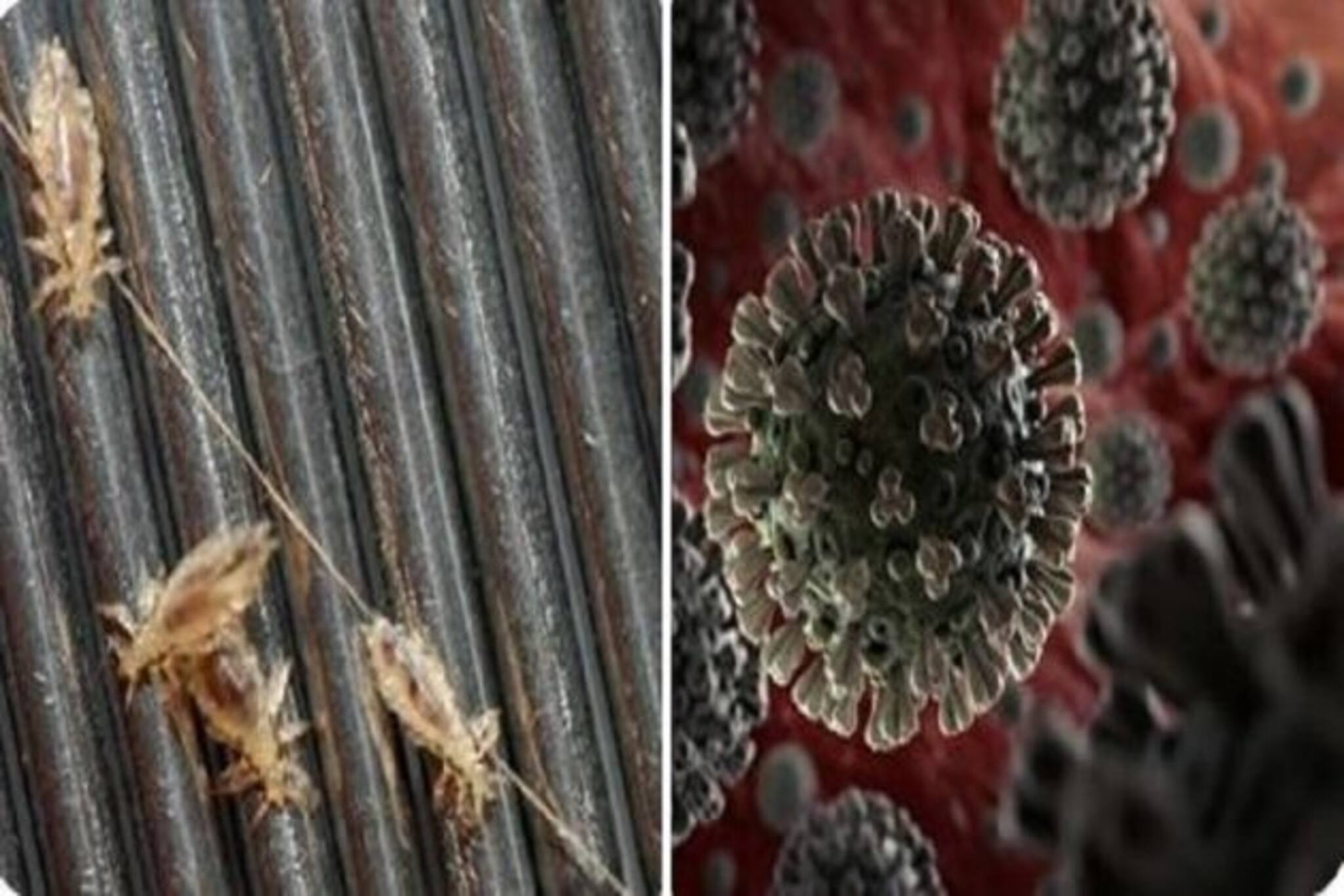 করোনাকে খতম করতে উকুন মারার ওষুধ! সবচেয়ে দ্রুত করছে কাজ, চাঞ্চল্যকর দাবি