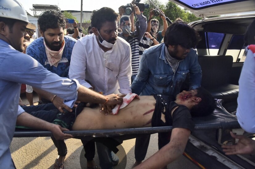  গ্যাস লিকের ফলে ক্ষত শরীরে। অ্যাম্বুলেন্সে তোলা হচ্ছে এক যুবককে। ছবি-AP