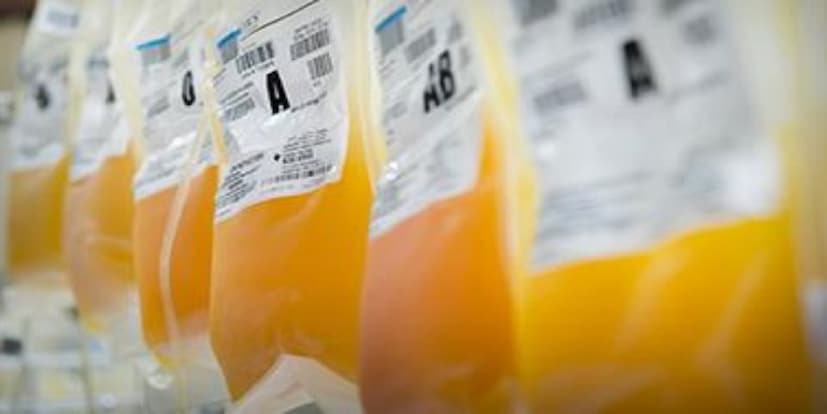  অন্যান্য আক্রান্তের তুলনায় তাঁদের মধ্যে অক্সিজেনের ঘাটতি কমেছে। দ্রুত শারীরিক অবস্থার উন্নতি হয়েছে। প্রাথমিকভাবে ১০জনের ক্লিনিক্যাল ট্রায়াল ইতিবাচক। আরও ৩০জনের উপর ক্লিনিক্যাল ট্রায়াল হবে। তারপরই চূড়ান্ত সিদ্ধান্তে আসা যাবে বলে জানিয়েছেন গবেষকরা। ইতিমধ্যে এই ১০ জনের উপর ক্লিনিক্যাল ট্রায়ালের রিপোর্ট CSIR ও স্বাস্থ্য দফতরে জমা পড়েছে। 