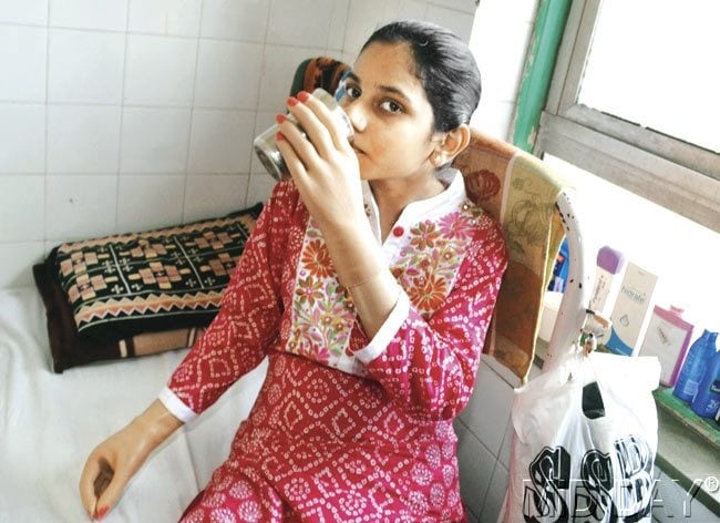 • এক মাস আগে অস্ত্রোপচার সফল হয় মণিকার । গত ২৪ অগাস্ট তাঁকে নতুন হাত দেন চিকিৎসকরা । গ্লোবাল হাসপাতাল সূত্রে খবর, ধীরে ধীরে তাঁর হাতের মধ্যে নতুন নার্ভ এবং হাড় তৈরি হচ্ছে । ফলে খুব সাবধানে অল্প অল্প করে হাত নাড়াতে পারছেন বছর চব্বিশের মণিকা মোরে । ছবি: সংগৃহীত । • এক মাস আগে অস্ত্রোপচার সফল হয় মণিকার । গত ২৪ অগাস্ট তাঁকে নতুন হাত দেন চিকিৎসকরা । গ্লোবাল হাসপাতাল সূত্রে খবর, ধীরে ধীরে তাঁর হাতের মধ্যে নতুন নার্ভ এবং হাড় তৈরি হচ্ছে । ফলে খুব সাবধানে অল্প অল্প করে হাত নাড়াতে পারছেন বছর চব্বিশের মণিকা মোরে । ছবি: সংগৃহীত ।