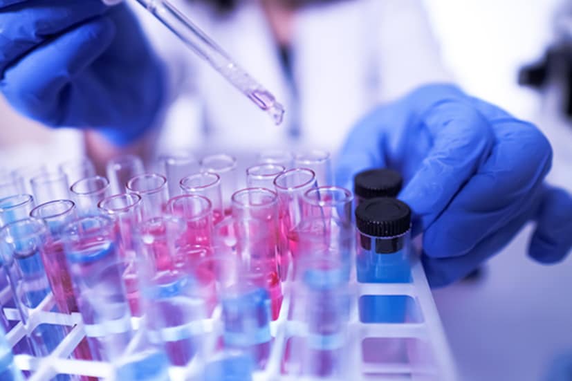 অত্যাধুনিক CRISPR প্রযুক্তি ব্যবহার করে এই টেস্ট কিট SAR-CoV-2 ভাইরাসের জেনোমিক সিকোয়েন্স নির্ণয় করবে৷ নতুন এই টেস্ট কিটের ফলাফল করোনা পরীক্ষায় ব্যবহৃত RT-PCR পদ্ধতির মতোই নিখুঁত হবে বলেও দাবি করা হচ্ছে৷ যদিও RT-PCR পদ্ধতির তুলনায় অনেক কম সময়ে এবং সহজে ও কম খরচে পরীক্ষার ফল মিলবে৷ 