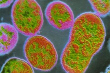 চিনে ফের সংক্রামক রোগের থাবা!‌ জটিল Brucellosis ‌‌রোগে আক্রান্ত হাজার হাজার