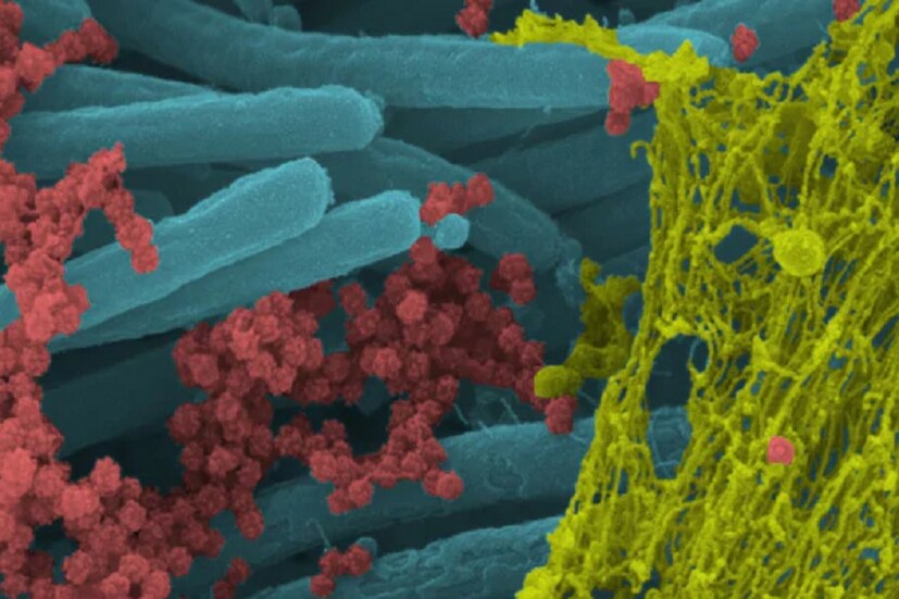 TATA CRISPR টেস্টেই বিশ্বে প্রথমবার করোনা ভাইরাস নির্ণয়ে Cas9 নামে বিশেষ এক ধরনের প্রোটিনের ব্যবহার করবে৷ CSIR-এর বিবৃতিতে এমনই দাবি করা হয়েছে৷ 