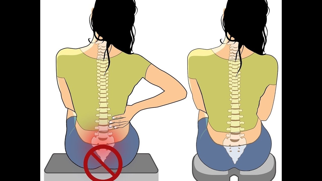 তবে, অনেকেরই কক্সিডাইনিয়া (coccydynia)-র ফলে বেশি মাত্রায় ব্যথা অনুভব হয়। বা বসতে, দাঁড়াতে সমস্যা হয়। তবে, এটা যে কক্সিডাইনিয়ার (coccydynia) জন্যই হয়, তা অনেকেই বুঝতে পারেন না। কক্সিডাইনিয়ার (coccydynia) ব্যথার স্বরূপ বোঝার আগে কক্সিডাইনিয়া কেন হয় সেটা জানতে হবে। বেশিরভাগ ক্ষেত্রেই কক্সিডাইনিয়ার কারণ জানা যায় না। তবে, কোনও ইনফেকশন, টিউমার বা চোট থেকে কক্সিডাইনিয়ার ব্য়থা হতে পারে। যেমন- তবে, অনেকেরই কক্সিডাইনিয়া (coccydynia)-র ফলে বেশি মাত্রায় ব্যথা অনুভব হয়। বা বসতে, দাঁড়াতে সমস্যা হয়। তবে, এটা যে কক্সিডাইনিয়ার (coccydynia) জন্যই হয়, তা অনেকেই বুঝতে পারেন না। কক্সিডাইনিয়ার (coccydynia) ব্যথার স্বরূপ বোঝার আগে কক্সিডাইনিয়া কেন হয় সেটা জানতে হবে। বেশিরভাগ ক্ষেত্রেই কক্সিডাইনিয়ার কারণ জানা যায় না। তবে, কোনও ইনফেকশন, টিউমার বা চোট থেকে কক্সিডাইনিয়ার ব্য়থা হতে পারে। যেমন-