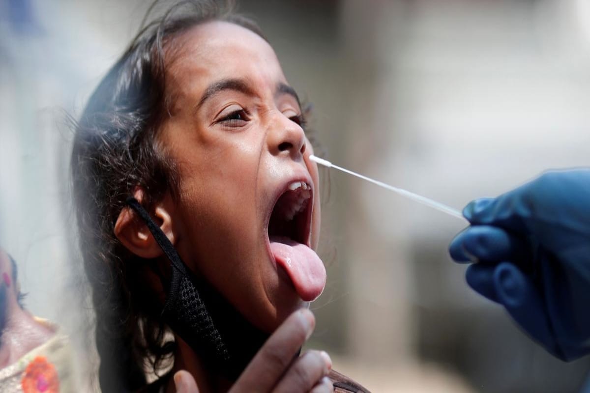 *Nature Journal Evidence-based Dentistry-তে প্রকাশিত হওয়া রিপোর্ট অনুযায়ী, ২০২০ সালে এমনই তিনটি মুখে ঘা এবং মুখের মধ্যে র্যাশের উপসর্গ থাকা করোনা রোগী তারা পেয়েছিলেন।অন্যদিকে, স্পেনের JAMA Dermatology-র গবেষণায় ২১ জনের স্কিন র্যাশ, ৬ জনের মুখ র্যাশের মতো উপসর্গ দেখা গিয়েছে। এমনকি দাঁত মাড়ি আলগা হয়ে দাঁত পড়ে যাওয়া, দাঁত ধূসর হয়ে যাওয়া সেনসিটিভিটি মতো ঘটনাও সামনে তুলে ধরেছে New York Times। প্রতীকী ছবি। *Nature Journal Evidence-based Dentistry-তে প্রকাশিত হওয়া রিপোর্ট অনুযায়ী, ২০২০ সালে এমনই তিনটি মুখে ঘা এবং মুখের মধ্যে র্যাশের উপসর্গ থাকা করোনা রোগী তারা পেয়েছিলেন।অন্যদিকে, স্পেনের JAMA Dermatology-র গবেষণায় ২১ জনের স্কিন র্যাশ, ৬ জনের মুখ র্যাশের মতো উপসর্গ দেখা গিয়েছে। এমনকি দাঁত মাড়ি আলগা হয়ে দাঁত পড়ে যাওয়া, দাঁত ধূসর হয়ে যাওয়া সেনসিটিভিটি মতো ঘটনাও সামনে তুলে ধরেছে New York Times। প্রতীকী ছবি।