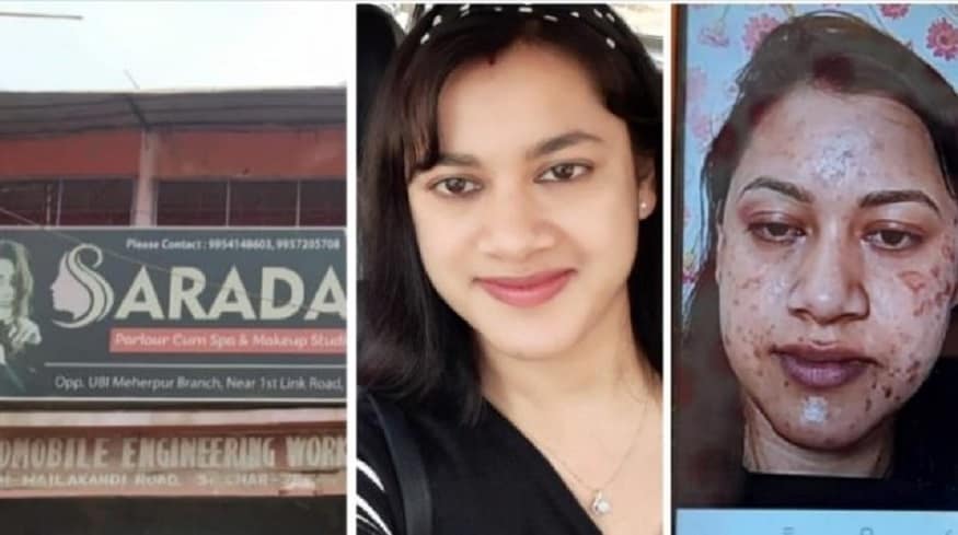 অভিযুক্ত পার্লারের যুগ্ম কর্নধার জানিয়েছেন তিনি নিজেও বিস্মিত এবং ক্ষমাপ্রার্থী ৷ তিনি বলেছেন, ‘আমার বাবা শয্যাশায়ী তাই আমি বা আমার স্ত্রী সেদিন পার্লারে ছিলাম না৷ যে অনভিপ্রেত ঘটনাটি ঘটেছে তার জন্য আমরা গভীর কষ্ট পাচ্ছি ৷ কিছু একটা ভীষণ ভুল হয়েছে আমার মনে হচ্ছে খালি যদি আমি সেটা আটকাতে পারতাম৷ ’ অভিযুক্ত পার্লারের যুগ্ম কর্নধার জানিয়েছেন তিনি নিজেও বিস্মিত এবং ক্ষমাপ্রার্থী ৷ তিনি বলেছেন, ‘আমার বাবা শয্যাশায়ী তাই আমি বা আমার স্ত্রী সেদিন পার্লারে ছিলাম না৷ যে অনভিপ্রেত ঘটনাটি ঘটেছে তার জন্য আমরা গভীর কষ্ট পাচ্ছি ৷ কিছু একটা ভীষণ ভুল হয়েছে আমার মনে হচ্ছে খালি যদি আমি সেটা আটকাতে পারতাম৷ ’