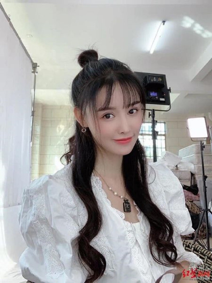 চিনা সোশ্যাল মিডিয়া প্ল্যাটফর্ম Weibo মঙ্গলবার কাটা নাকের ছবি পোস্ট করেছেন৷ কসমেটিক সার্জারি করাতে গিয়ে এই অবস্থা বলে জানিয়েছেন অভিনেত্রী ও গায়িকা৷ এটাকে তিনি বিবরণ, চিনা সোশ্যাল মিডিয়া প্ল্যাটফর্ম Weibo মঙ্গলবার কাটা নাকের ছবি পোস্ট করেছেন৷ কসমেটিক সার্জারি করাতে গিয়ে এই অবস্থা বলে জানিয়েছেন অভিনেত্রী ও গায়িকা৷ এটাকে তিনি বিবরণ,