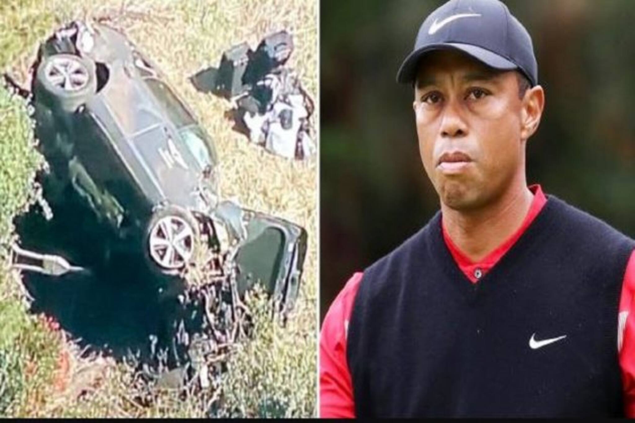 মারাত্মক গাড়ি দুর্ঘটনা, টাইগার উডসের, দুটি পায়েই হল অস্ত্রোপচার