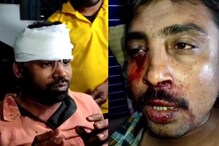 বিজেপি-তৃণমূল সংঘর্ষে রক্তাক্ত ডোমজুড়, মহিলা-বাচ্চাদেরও রেয়াত করল না দুষ্কৃতির বিজেপি-তৃণমূল সংঘর্ষে রক্তাক্ত ডোমজুড়, মহিলা-বাচ্চাদেরও রেয়াত করল না দুষ্কৃতির