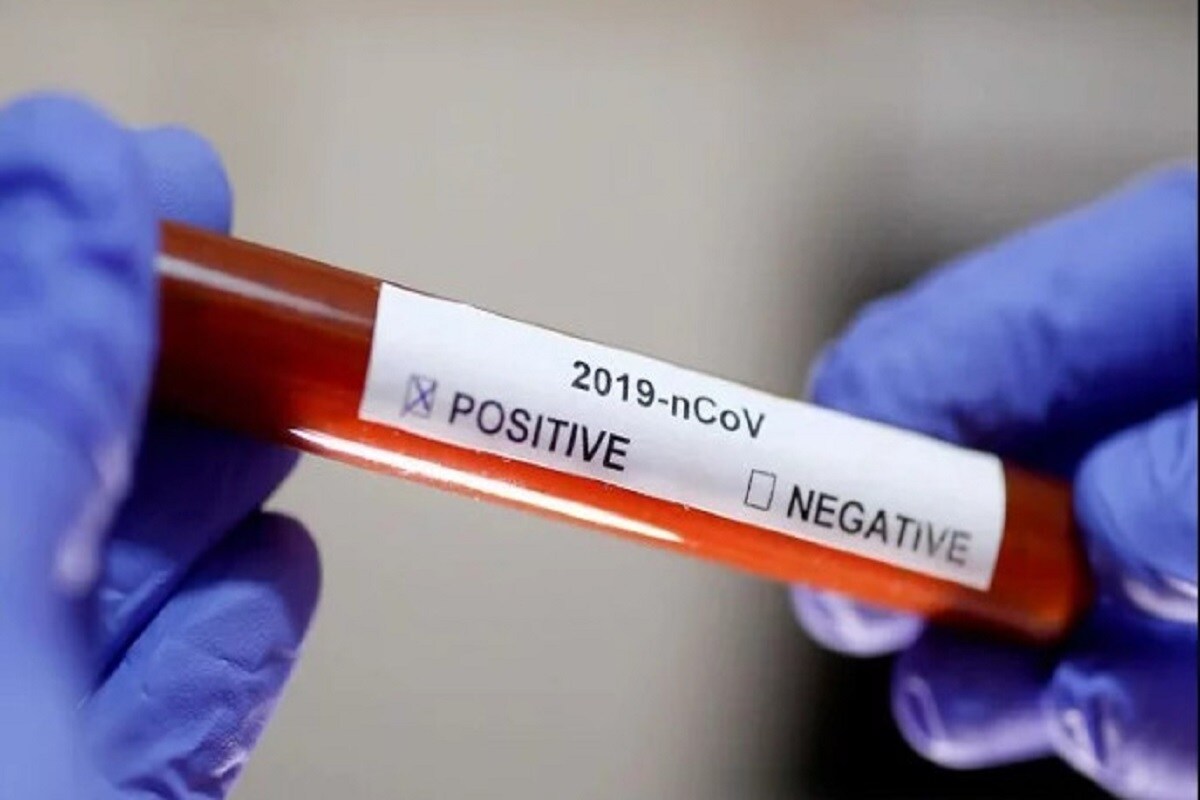 *রবিবার দিল্লিতে করোনা আক্রান্ত (Covid Positive) হয়েছেন ১০,৭৩২ জন। ২০২০ সাল থেকে আজকের দিন পর্যন্ত এটাই সর্বাধিক, জানিয়েছেন দিল্লির মুখ্যমন্ত্রী অরবিন্দ কেজরিওয়াল। সংগৃহীত ছবি। *রবিবার দিল্লিতে করোনা আক্রান্ত (Covid Positive) হয়েছেন ১০,৭৩২ জন। ২০২০ সাল থেকে আজকের দিন পর্যন্ত এটাই সর্বাধিক, জানিয়েছেন দিল্লির মুখ্যমন্ত্রী অরবিন্দ কেজরিওয়াল। সংগৃহীত ছবি।