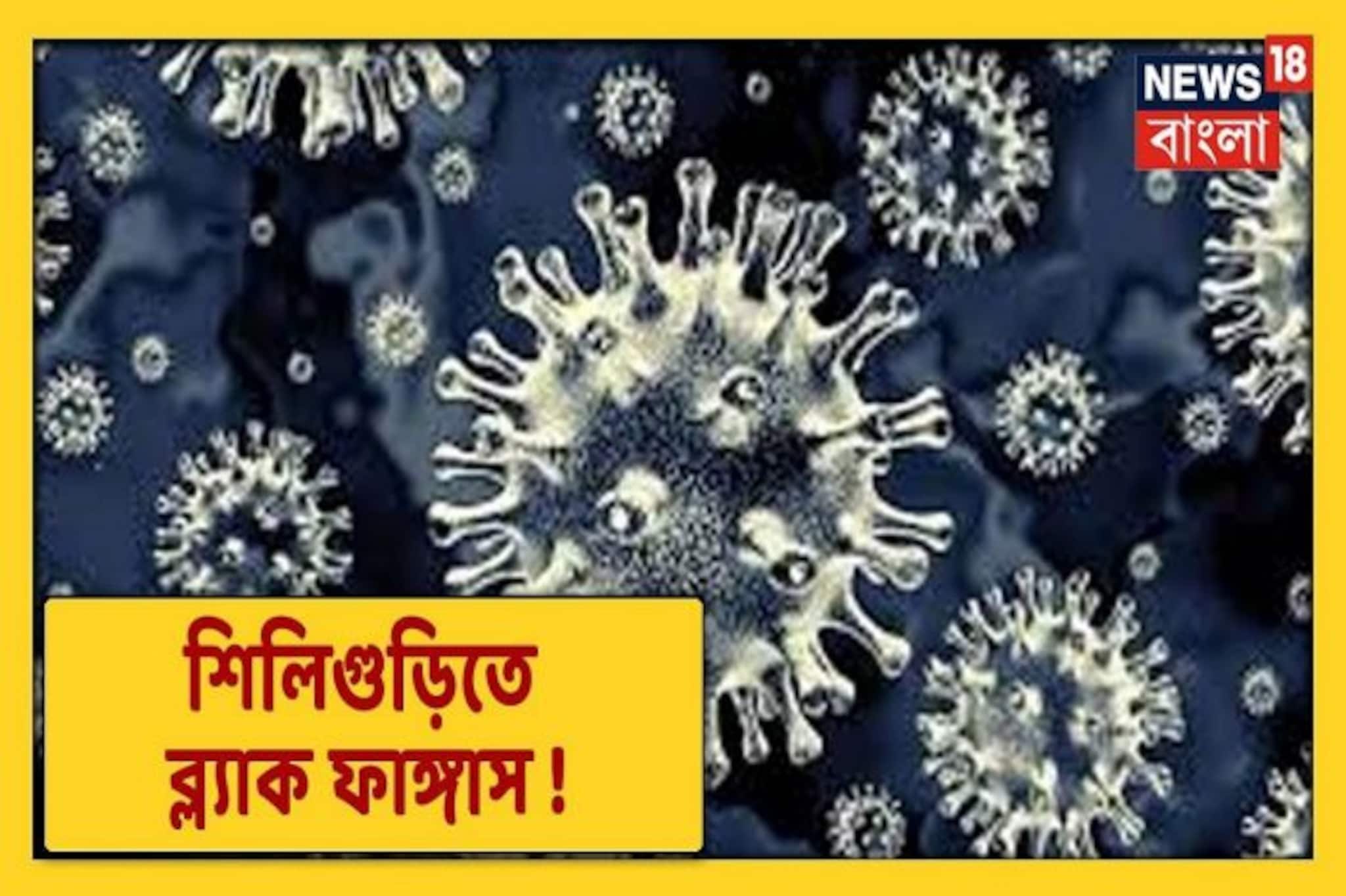 Video: এবার উত্তরে হানা ব্ল্যাক ফাঙ্গাসের, শিলিগুড়িতে প্রথম আক্রান্ত মহিলা!