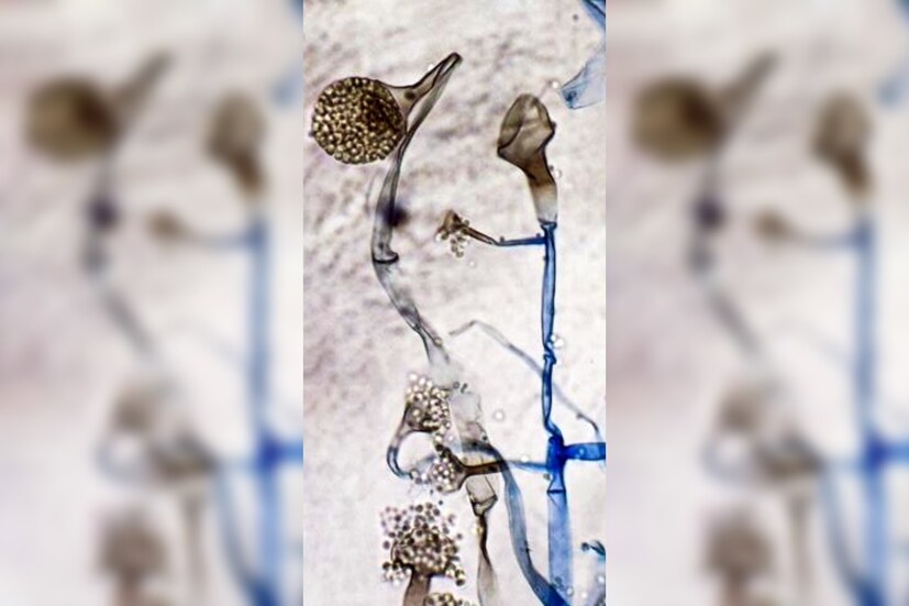 • তাঁরা বলছেন, হ্যাঁ পারেন । একবারও করোনা সংক্রমণ হয়নি এমন ব্যক্তিও এই রোগে আক্রান্ত হতে পারেন । সম্ভাবনা বেশি থাকছে হাই ব্লাড সুগারের রোগীদের ক্ষেত্রে । তাই খুব উচ্চ মাত্রায় ডায়াবেটিস যাঁজের রয়েছে, তাঁরা এখনই সাবধান হয়ে যান, এমনটাই বলছেন নীতি আয়োগ (স্বাস্থ্য)-এর সদস্য ভিকে পাল ।