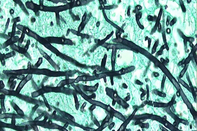 *এই মুহূর্তে মোট সন্দেহজনক আক্রান্ত বেড়ে ২০ জন। মোট সন্দেহজনক আক্রান্তের মৃত্যু হয়েছে চার জনের। সংগৃহীত ছবি। 