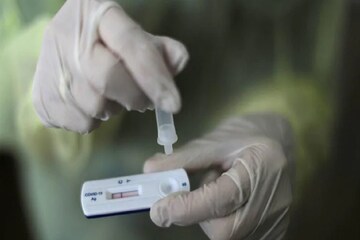 HIV+ মহিলার শরীরে ২১৬দিনে ৩২ বার করোনার চরিত্র বদল!নয়া ঝড়ের আশঙ্কায় কাঁপছে বিশ্ব