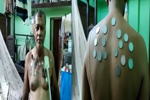 Bizarre! কোভিশিল্ডের ডোজ নিয়েই শরীরে আটকে যাচ্ছে হাতা-খুন্তি-কয়েন! দুশ্চিন্তায় শিলিগুড়ির 'ম্যাগনেট ম্যান' Bizarre! কোভিশিল্ডের ডোজ নিয়েই শরীরে আটকে যাচ্ছে হাতা-খুন্তি-কয়েন! দুশ্চিন্তায় শিলিগুড়ির 'ম্যাগনেট ম্যান'