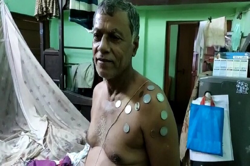 *চরম বিষ্ময়ে নেপাল চক্রবর্তী বিষয়টি জানান আত্মীয়-স্বজনদের। তবে এখনও চিকিৎসকের সঙ্গে দেখা করেননি। শীঘ্রই তিনি চিকিৎসকদের শরণাপন্ন হবে বলে জানিয়েছেন। 