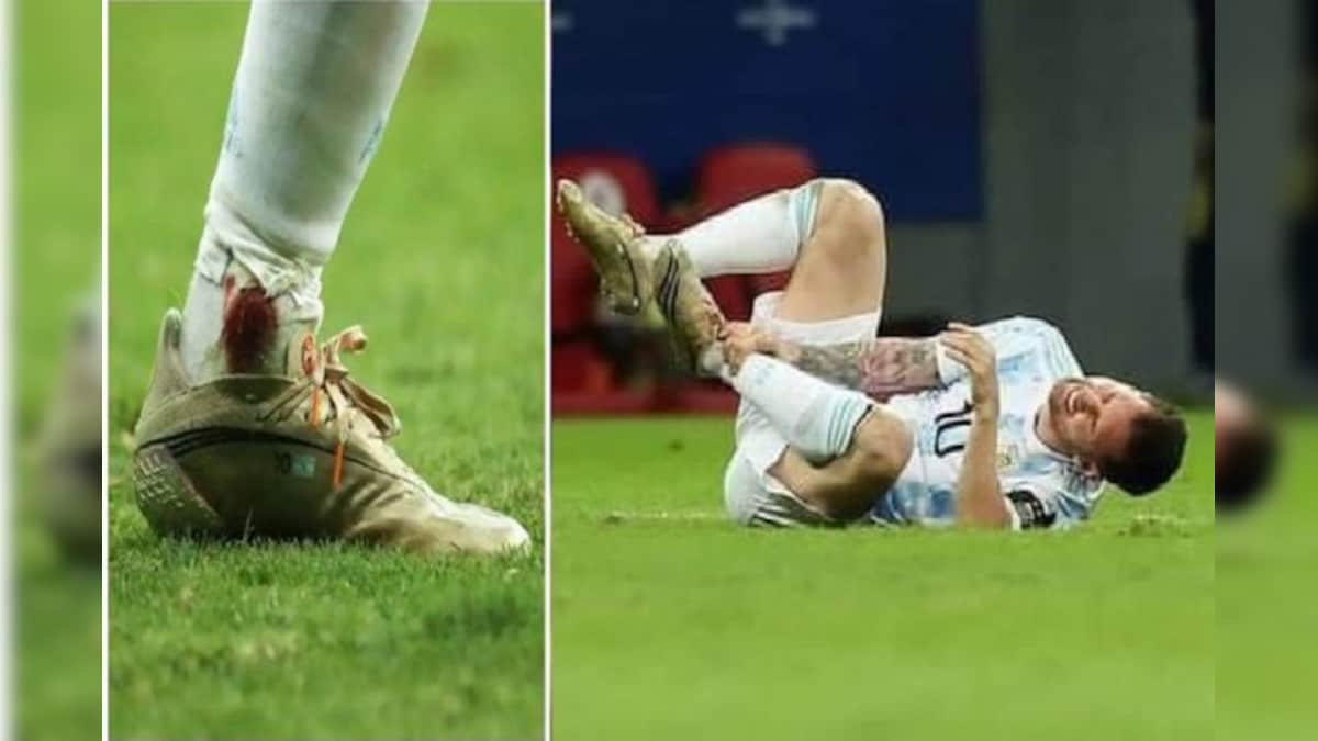 Lionel Messi plays with bleeding ankle against Colombia in Copa America