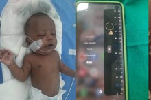 গিলে ফেলা সোনার নথ এক সপ্তাহ ধরে শ্বাসনালীতে, জটিল অস্ত্রোপচারে সুস্থ নবজাতক