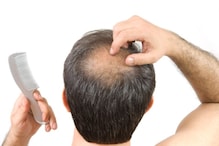 Hairfall in men: ঘরে ঘরে পুরুষদের টাক পড়ার সমস্যা! ৬টি ঘরোয়া উপায়েই দ্রুত পেতে পারেন সুফল Hairfall in men: ঘরে ঘরে পুরুষদের টাক পড়ার সমস্যা! ৬টি ঘরোয়া উপায়েই দ্রুত পেতে পারেন সুফল