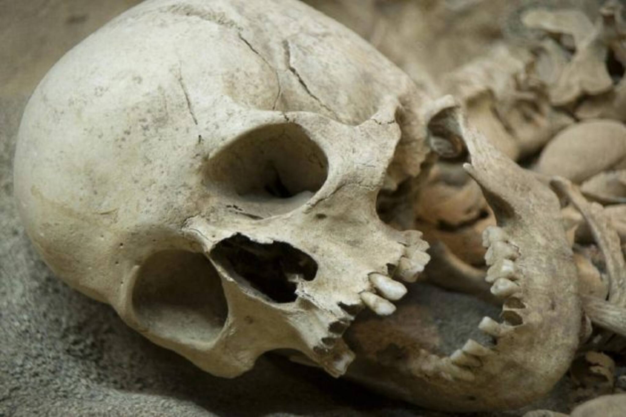Human Skeleton: দাসপুরের গ্রামে উদ্ধার মাথার খুলি, হাড়গোড়! ব্যাপক চাঞ্চল্য এলাকায়