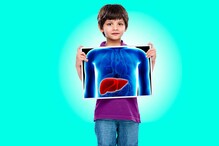 বিশ্বে প্রতি বছর ১০ কোটির বেশি মানুষ Hepatitis A রোগে আক্রান্ত হন, WHO-এর অনুমান বিশ্বে প্রতি বছর ১০ কোটির বেশি মানুষ Hepatitis A রোগে আক্রান্ত হন, WHO-এর অনুমান
