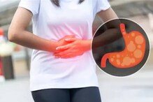Acid Reflux: এই নিয়ম ও ঘরোয়া টোটকাগুলিকে মনে রাখুন, পালাবার পথ পাবে না পুরনো অম্বলের অসুখ Acid Reflux: এই নিয়ম ও ঘরোয়া টোটকাগুলিকে মনে রাখুন, পালাবার পথ পাবে না পুরনো অম্বলের অসুখ