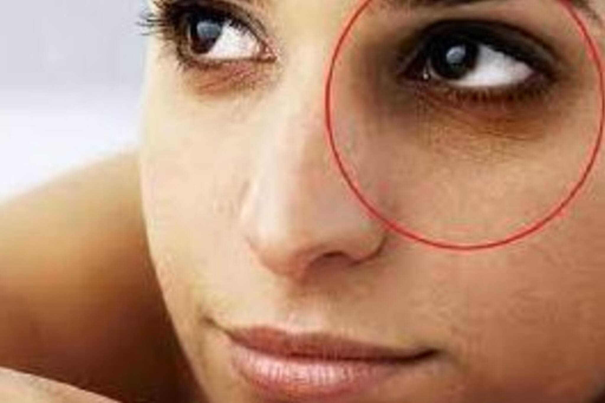 Dark Circle | Skin care: চোখের চারপাশ ঘিরে পড়ছে কালি! ডার্ক সার্কল এড়াতে এই ৬টি কাজ করে দেখতে পারেন