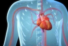 অ্যাঞ্জিওপ্লাস্টি চিকিৎসায় Bioresorbable Scaffold-এর সাহায্যে তৈরি কলকাতা