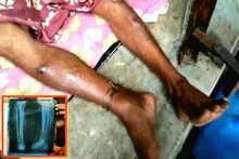 স্ত্রী ও মেয়ের অত্যাচার, পা ভেঙে বিনাচিকিৎসায় পরে রয়েছেন স্বামী