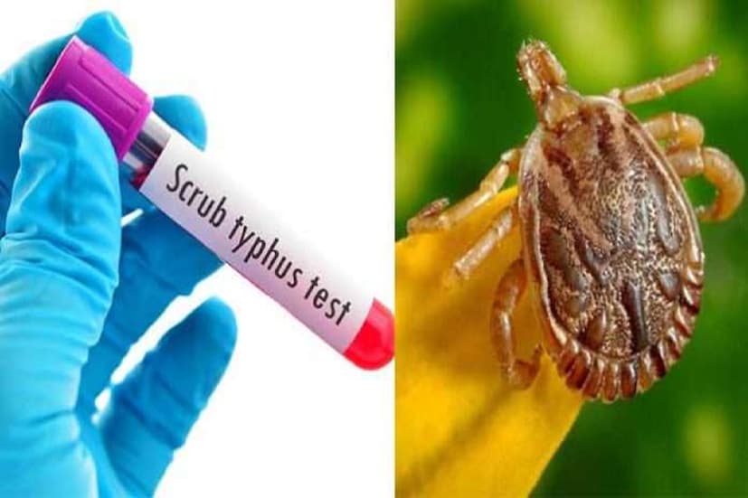 এদিকে, অজানা জ্বরের থাবা এবার দুর্গাপুরেও (Child Fever in Durgapur)। গত কয়েকদিনে সেখানে আক্রান্ত হয়েছে ৪২টি শিশু। সকলেই দুর্গাপুর মহকুমা হাসপাতালে চিকিৎসাধীন বলে জানা গিয়েছে। জ্বর, সর্দি-কাশি সহ একাধিক উপসর্গ রয়েছে তাদের। অনেকের রয়েছে শ্বাসকষ্টের সমস্যাও।
