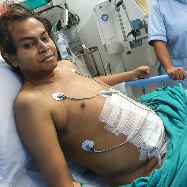 প্রকাণ্ড ওই টিউমার পেট কেটে বের করা সহজ ছিল না। দীপঙ্কর সরকার অর্ণবকে রেফার করেন ডা. মাখনলাল সাহার কাছে। এসএসকেএম হাসপাতালের অস্ত্রোপচারের বিভাগের প্রাক্তন বিভাগীয় প্রধান, দক্ষ শল্য চিকিৎসক মাখনলাল। তাঁর কথায়, “প্রথমটায় উনি ধরতে পারেননি। পেটটা ভার ভার থাকত। সব সময় বমি বমি ভাব। শেষ তিন-চার মাস ধরে সাংঘাতিক অবস্থা।”