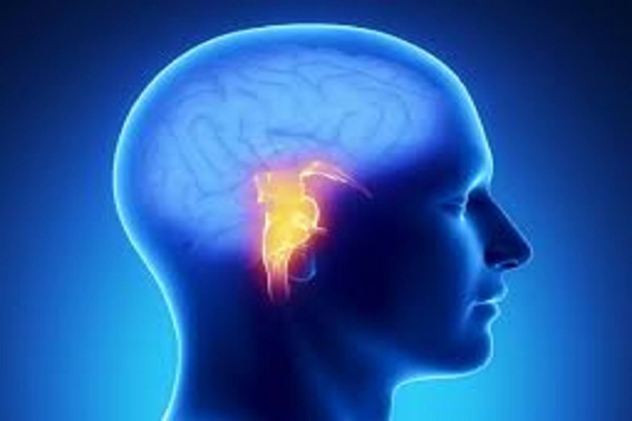 Brain Stroke| Health: বাড়ছে না তো ব্রেন স্ট্রোকের ঝুঁকি? জানুন বুঝবেন কী ভাবে