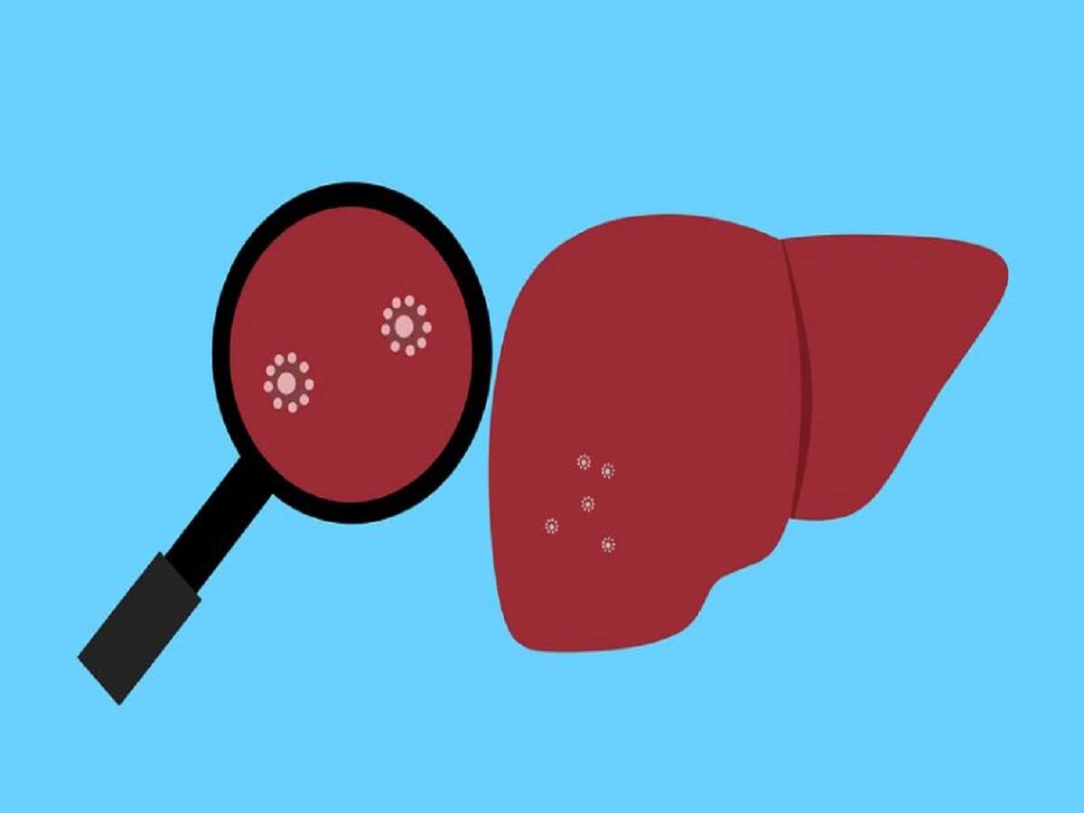 early signs of liver damage from excessive drinking and remedies