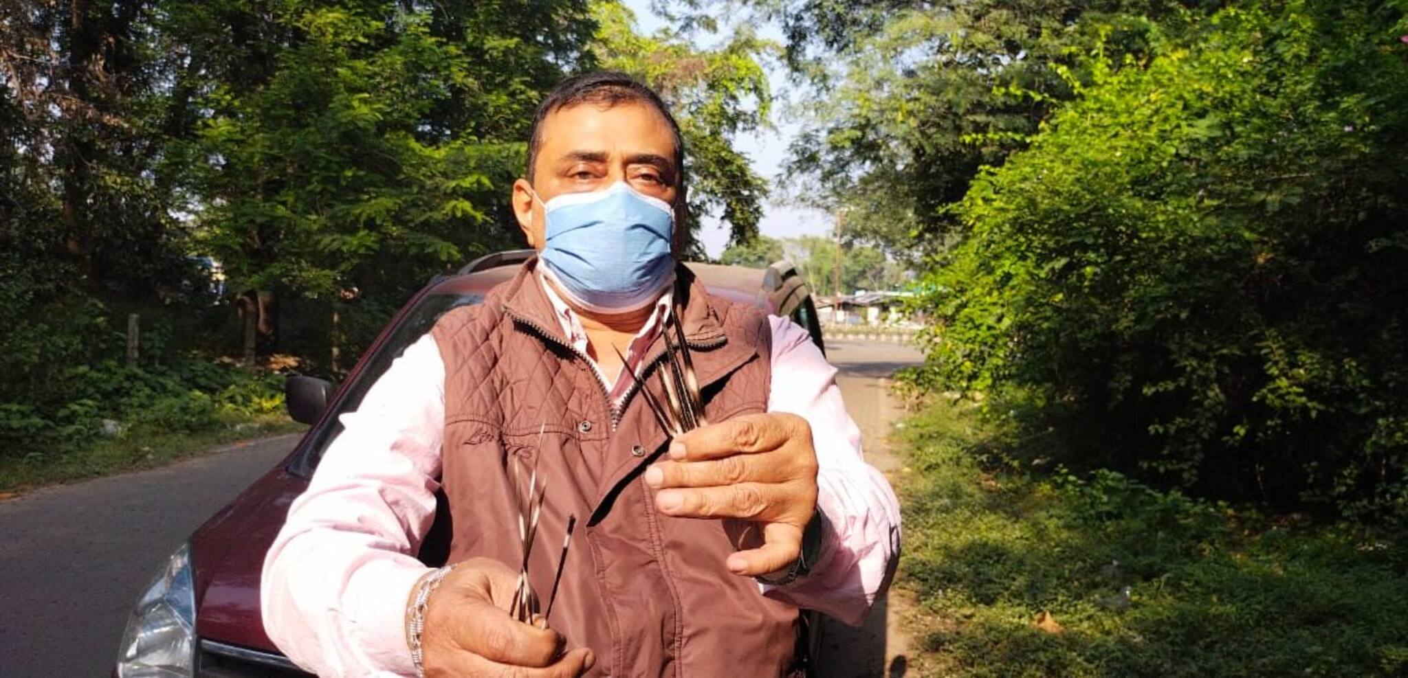 Bangla Video: দুর্গাপুরের ব্যস্ত রাস্তায় হঠাৎ এক ব্যক্তিকে আক্রমণ সজারুর