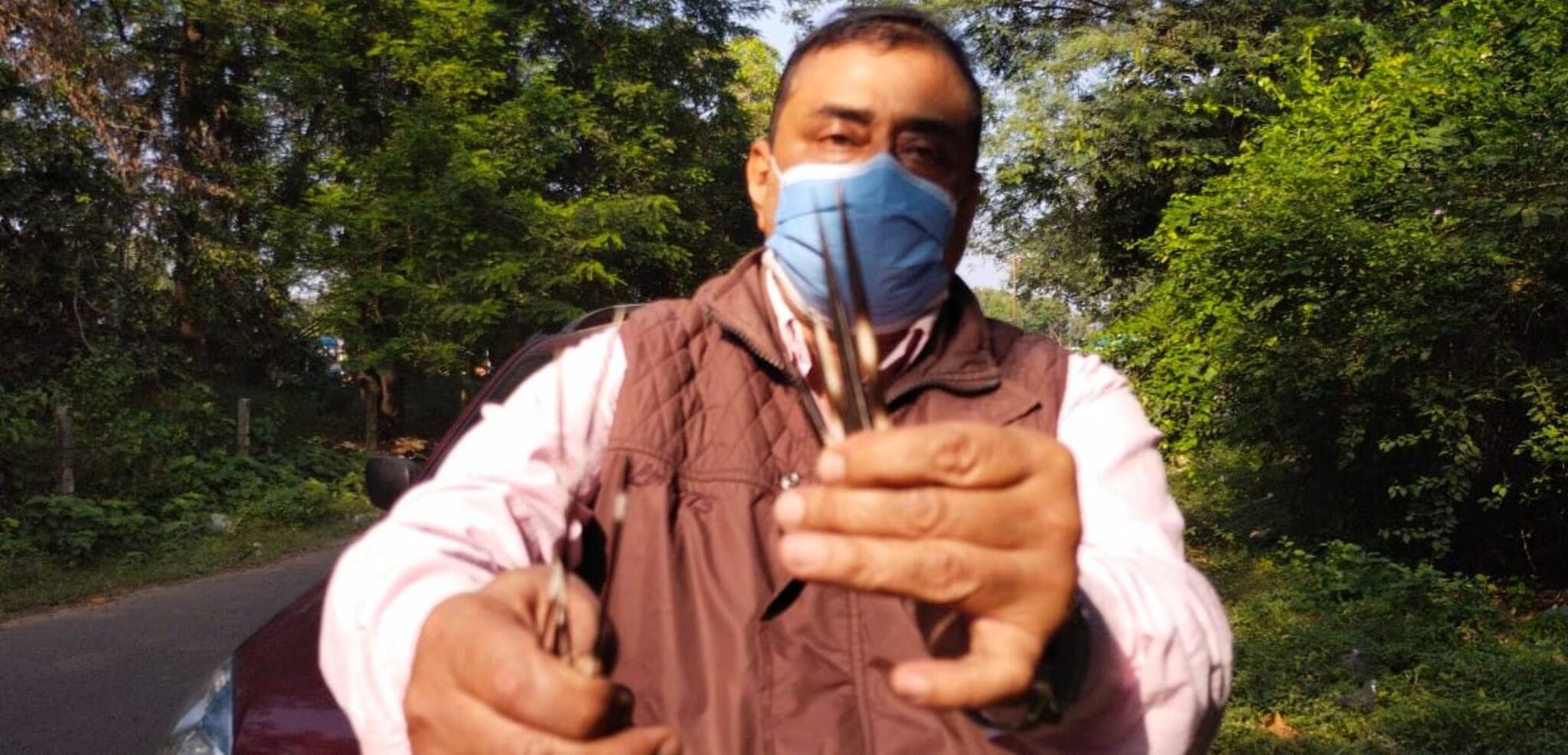 West Bardhaman News|| দুর্গাপুরে মাঝরাস্তায় এক ব্যক্তি সজারুর আক্রমণ! আতঙ্ক...